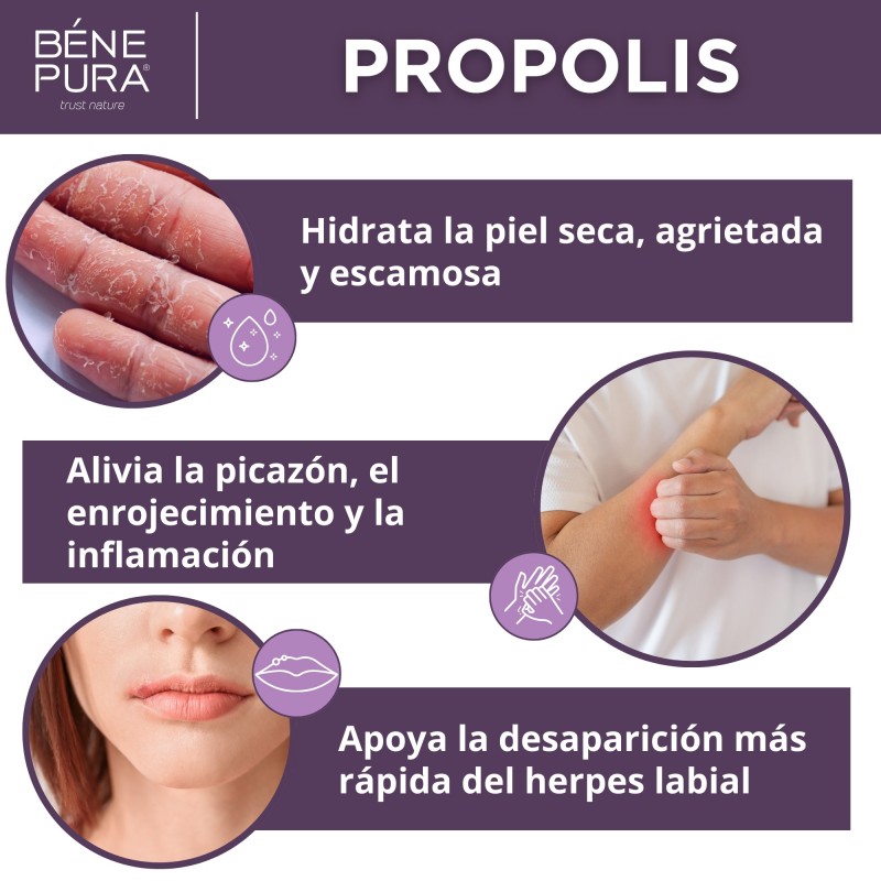 2x Pomada para irritaciones de la piel con 30% Propóleo - 40ml