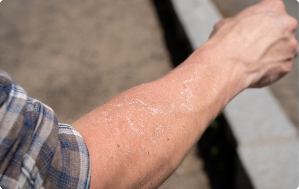 Como aceite para pieles irritadas y secas