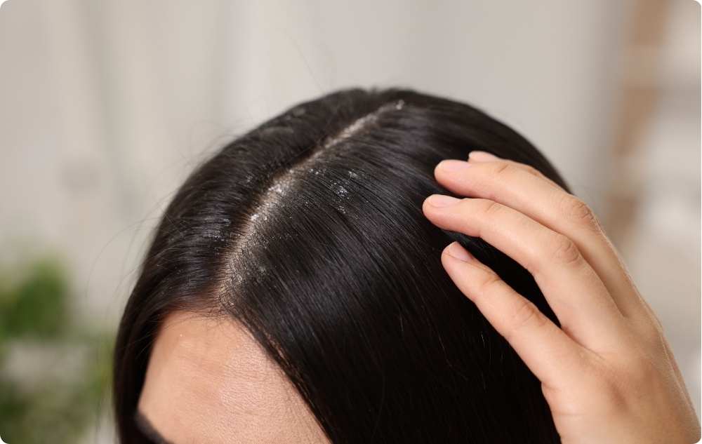 Como aceite de masaje para el cuero cabelludo en caso de caída del cabello y cabello débil