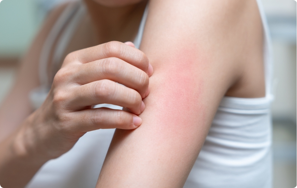 Como agente antiséptico y antibacteriano para lesiones menores de la piel