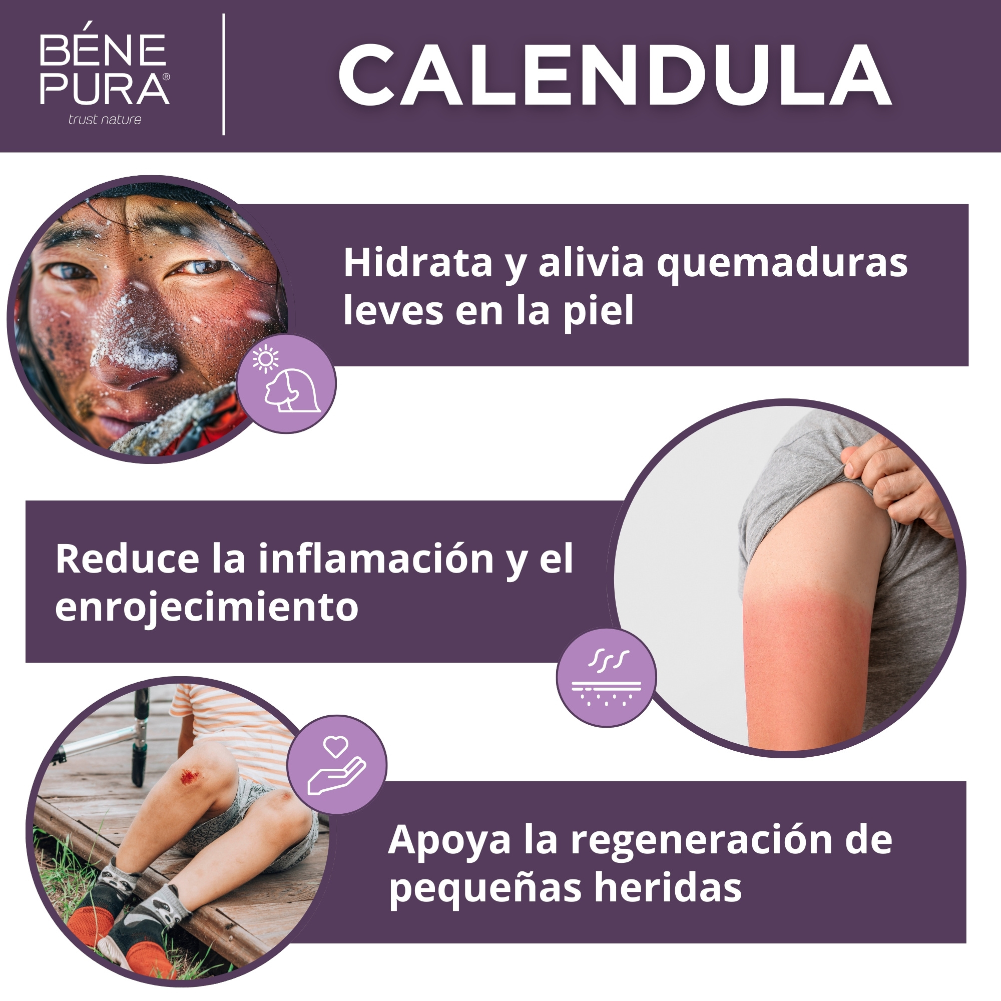 Set "Ungüentos para heridas, quemaduras e irritaciones de la piel"